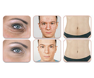 Velform New Today 59,99€